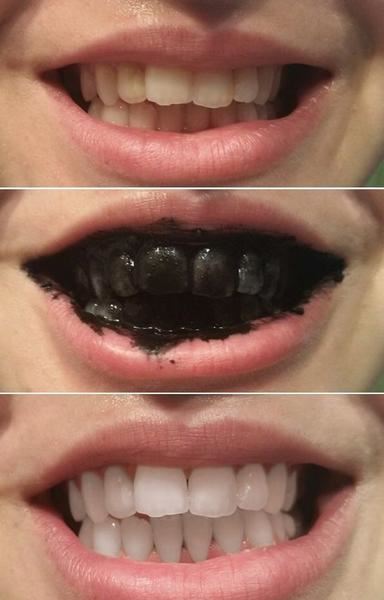 Teeth Whitening black toothpaste with activated charcoal (30 g) - Fashiongirl